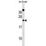 Derlin-2 (DERL2) Antibody