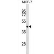Eukaryotic Initiation Factor 4A-III (EIF4A3) Antibody