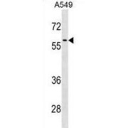 Regulator Of Chromosome Condensation 2 (RCC2) Antibody