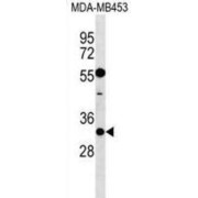 Kv Channel-Interacting Protein 2 (KCNIP2) Antibody