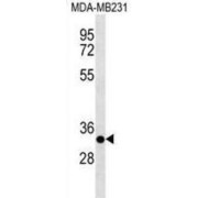 Calpain Small Subunit 2 (CAPNS2) Antibody