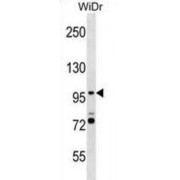 SMG5, Nonsense Mediated mRNA Decay Factor (SMG5) Antibody