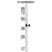 AKT Interacting Protein (AKTIP) Antibody