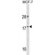 Cyclin Dependent Kinase 2 Associated Protein 2 (CDK2AP2) Antibody