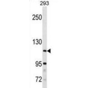 SH3 Domain Binding Protein 4 (SH3BP4) Antibody