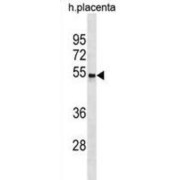 Cholecystokinin A Receptor (CCKAR) Antibody