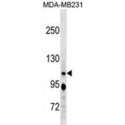 Retinoblastoma-Like Protein 1 (RBL1) Antibody