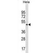 Splicing Factor 3B Subunit 4 (SF3B4) Antibody