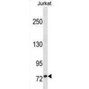 Zinc Finger Protein 274 (ZNF274) Antibody