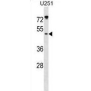 Integrin-Linked Kinase-Associated Serine/threonine Phosphatase 2C (ILKAP) Antibody