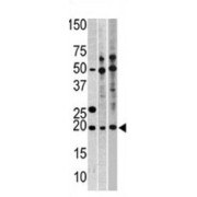 Ribosomal Protein L23A (RPL23A) Antibody