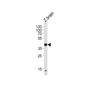 Eukaryotic Translation Initiation Factor 3 Subunit E (EIF3E) Antibody