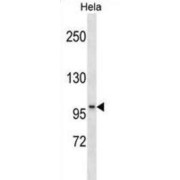 Slingshot Homolog 1 (SSH1) Antibody