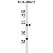 Voltage-Gated Potassium Channel Subunit Beta-1 (KCNAB1) Antibody