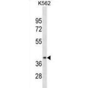 Cyclin D1 Binding Protein 1 (CCNDBP1) Antibody