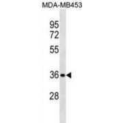 Syntaxin 11 (STX11) Antibody