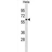 Zinc Finger Protein 410 (ZNF410) Antibody