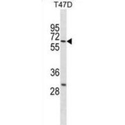 Probable ATP-Dependent RNA Helicase DDX41 (DDX41) Antibody