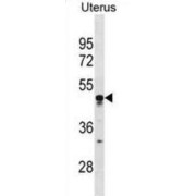 T-Cell immunoglobulin and mucin domain-Containing protein 4 (TIMD4) Antibody