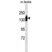 RecQ Like Helicase 4 (RECQL4) Antibody