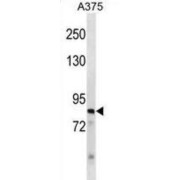 Zinc Finger Protein 148 (ZNF148) Antibody