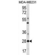 Transcription Factor Spi-B (SPIB) Antibody