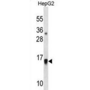 Glia Maturation Factor Beta (GMFB) Antibody