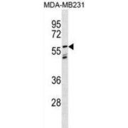 Leucine Rich Repeat LGI Family, Member 3 (LGI3) Antibody