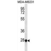 Transcription Factor EC (TFEC) Antibody