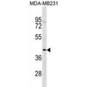 TOX High Mobility Group Box Family Member 2 (TOX2) Antibody