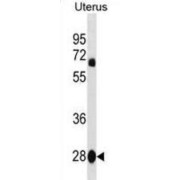 Transcription Cofactor Vestigial-Like Protein 4 (VGLL4) Antibody