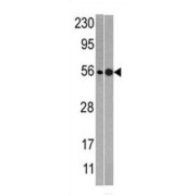 NMD3 Ribosome Export Adaptor (NMD3) Antibody