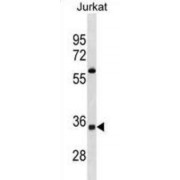 Olfactory Receptor Family 52 Subfamily A Member 5 (OR52A5) Antibody