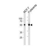 Estrogen Receptor Beta (ESR2) Antibody