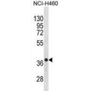 Chemokine C-X-C-Motif Receptor 4 (CXCR4) Antibody
