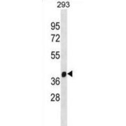 E3 Ubiquitin-Protein Ligase FANCL (FANCL) Antibody