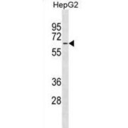 Major Facilitator Superfamily Domain-Containing Protein 4 (MFSD4) Antibody