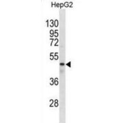 Gamma-Aminobutyric Acid Receptor Subunit Rho-1 (gABRR1) Antibody