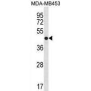 Annexin A13 (ANXA13) Antibody