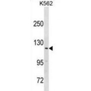 Probable E3 Ubiquitin-Protein Ligase HERC3 (HERC3) Antibody