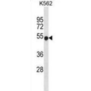 Wiskott-Aldrich Syndrome (WAS) Antibody