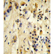 Eukaryotic Translation Initiation Factor 4E Type 2 (EIF4E2) Antibody