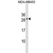 Apoptosis Regulator Bcl-2 (BCL2) Antibody