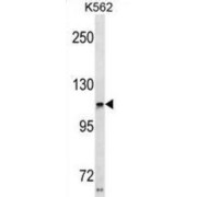 Harmonin (USH1C) Antibody