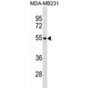Putative Zinc Finger And SCAN Domain-Containing Protein 5C (ZSCAN5C) Antibody