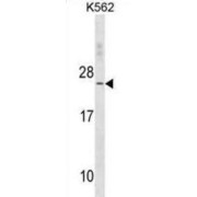 Troponin C Type 2 (TNNC2) Antibody