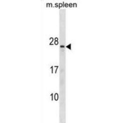 Troponin C Type 2 (TNNC2) Antibody