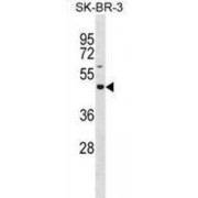 Glycosyltransferase 8 Domain-Containing Protein 4 (GLT8D4) Antibody