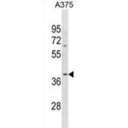 Olfactory Receptor Family 13 Subfamily D Member 1 (OR13D1) Antibody