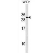 FAS-Associated Death Domain Protein (FADD) Antibody